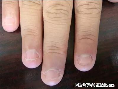 剪指甲、挖耳屎,这些日常小动作竟隐藏大危害! - 榆林生活资讯 - 榆林28生活网 yl.28life.com